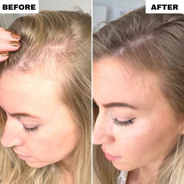 Hair Spa Massager Set